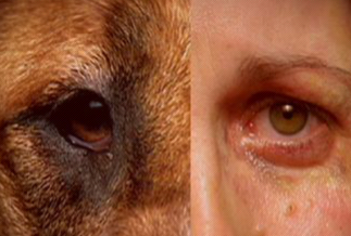 SPCA